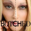 Botched S08E15 1080p WEB h264-EDITH thumb